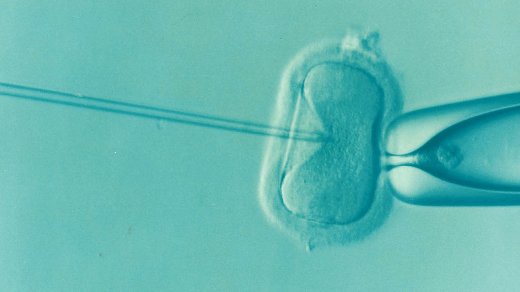 The IVF process under a microscope