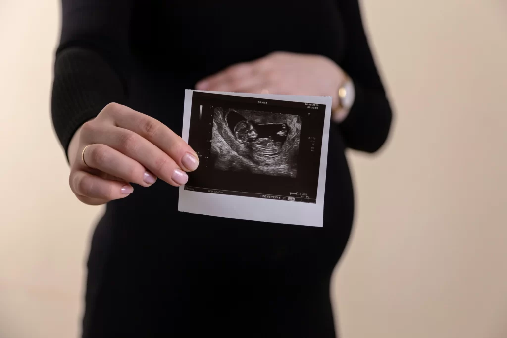 A woman on the upper range of the surrogate age limit proudly shows off an ultrasound image of the baby she carries